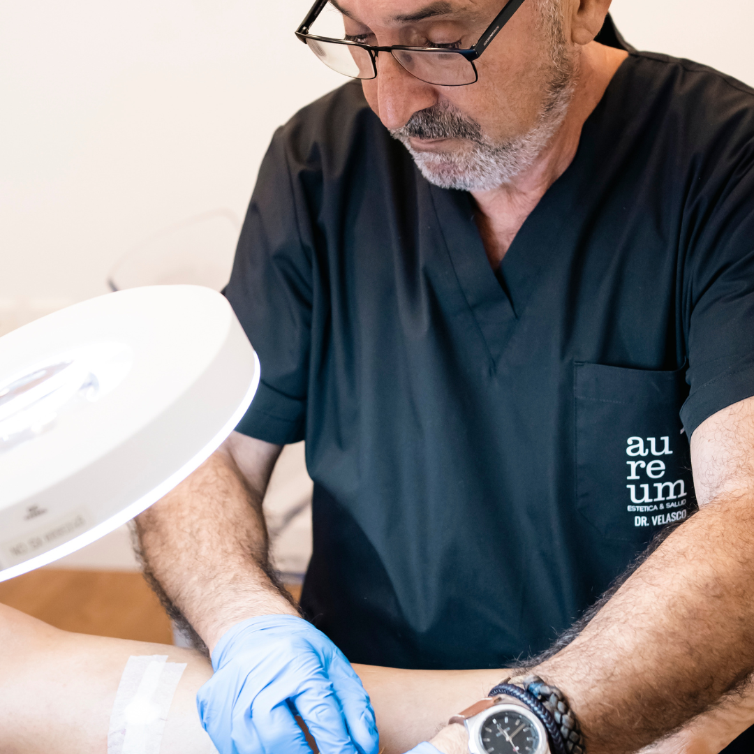 escleroterapia